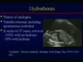 Download Lagu Fetal Thoracic Abnormalities
