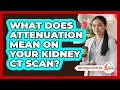 What Does Attenuation Mean On Your Kidney CT Scan - Kidney Cancer Support Hub