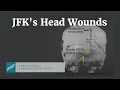 JFK s Head Wounds