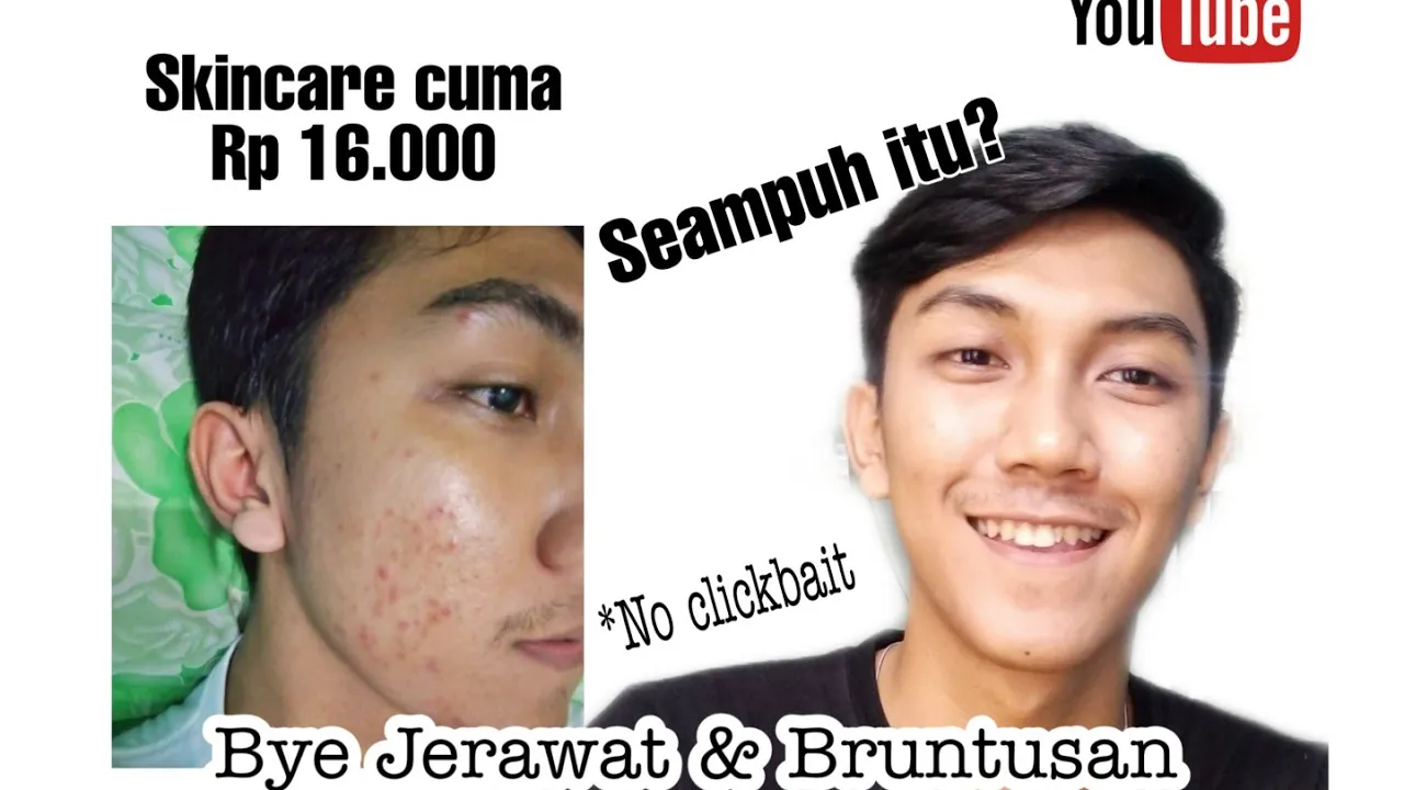 
          
          
          
            
            [TIPS] Cara menghilangkan jerawat dan bruntusan | Skincare murah untuk anak kos
          
        . 