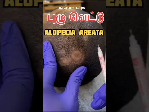 தினமும் ஐந்து அழகு குறிப்புகள் #beautytips #skincare #beautycare #skincaretips #tamiltips #tips