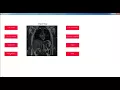 Projects on Image Processing with Source Code Thesis on Image Processing with Source Code