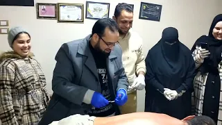 شرح عملى الإبر الصينية والحجامة فارسكور محافظة دمياط 
