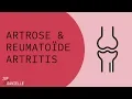 Download Lagu Artrose en Reumatoïde Artritis