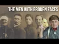 Download Lagu Transforming Faces | World War 1 and the birth of modern plastic surgery