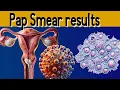 Pap Smear Results Explained under 3 minutes