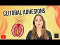 Clitoral Adhesions
