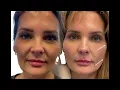 EVOLVE MEDSPA