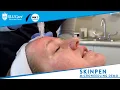Skinpen Microneedling How it Works Demonstration - SLUCare MedSpa