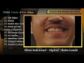 TEH HIJAU - Tulus | 1000x - Ghea Indrawari | BERSENJA GURAU - Raim Laode | LAGU TOP SPOTIFY