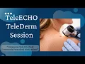 TeleECHO TeleDerm Session 38 - Cutaneous Side Effects of Commonly Prescribed Medications