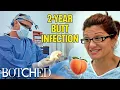 Misty is Unhappy With Dr Dubrow Removing Her Painful Butt Implants Before After Botched E
