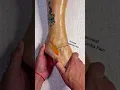 Kinesiology Massage goes deeper than just relaxation it corrects the real root cause of your pain