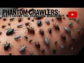 Why You Feel Ants Crawling on Your Skin Understanding Paresthesia