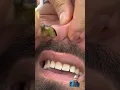 Download Lagu 👃 nose waxing for man's reaction 😂 #nosewaxing#cutssaloon #mux9tvsalon #hairstyle
