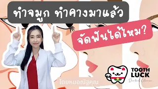  ทำจมูกหรือคางมาแล้วสามารถจัดฟันได้หรือไม่ 