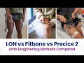Lagu Limb Lengthening Methods Compared | LON vs Fitbone vs Precice 2