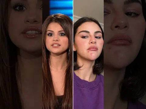 Celebrities With The WORST Jawline Filler