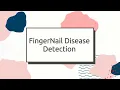 Fingernail Disease Detection Using Convolutional Neural Network CNN Final Year IEEE Project Code