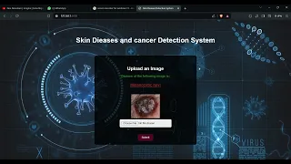 Skin Disease Classification Using CNN Deep Learning Project AI