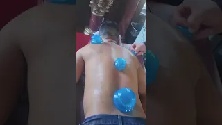 Cupping or Vendosa Massage 50 15 minutes Kenwood Hyde Park Justice Ivanhoe