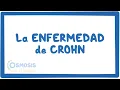 Download Lagu La enfermedad de Chron - causas, síntomas, diagnóstico, tratamiento, patología