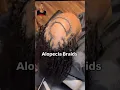 She has Alopecia - but watch how she got the perfect Braid