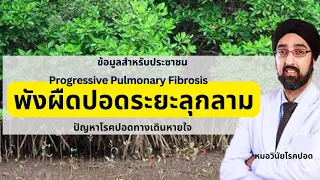 พังผืดปอดรักษาอย่างไร และยาชะลอพังผืดทำงานอย่างไร