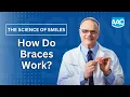 How Do Braces Work