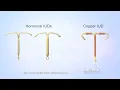 What is an IUD