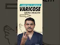 Varicose Vein EXPERT Shares Top 3 Exercises for Relief