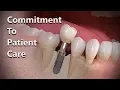 Why you should see an oral surgeon