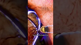 ماذا يحدث لجسمك عند اختراق الرصاصة  ماذا يحدث لجسمك عند اختراق الرصاصة