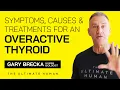 Hyperthyroidism Symptoms Causes and Treatments For An Overactive Thyroid TUH