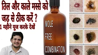 Download Homeopathic Mole free combination | तिल और काले मस्सों को जड़ से खत्म कीजिए | MP3