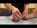 About Our Acupuncture Services The Naylor Clinic of Chiropractic and Acupuncture