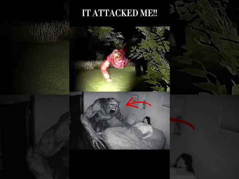 It attacked me…