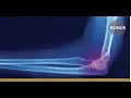 Cant Miss X-rays in Urgent Care Part 2 Extremity X-Rays - A Frank Discussion MC CME Podcast