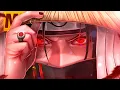 Download Lagu Tipo Itachi 😏 (Naruto) Prod. Sidney Scaccio | MHRAP