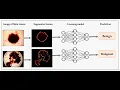 Skin Disease Detection Using Neural Network Python OpenCV Project Source Code