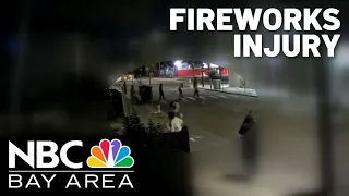 Teen in Berkeley seriously injured by illegal fireworks