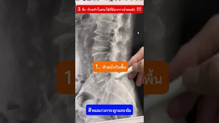 ทำไมคนที่มีอาการปวดหลังควรหลีกเลี่ยงการนอนคว่ำ