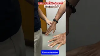  กล้ามเนื้อในมืออ่อนแรงและมีอาการบวมที่นิ้ว เกิดจากสาเหตุอะไร 