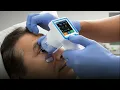 NPi -300 Pupillometer System Full System Setup and Pupil Exam CLOSED CAPTION