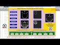 Image Fusion Using Wavelet Transform Image Fusion Using Matlab Code Image Fusion Using DWT