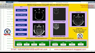 Image Fusion Using Wavelet Transform Image Fusion Using Matlab Code Image Fusion Using DWT