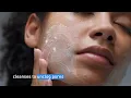Clear Acne and Prevent New Breakouts CeraVe Skincare