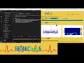 EEG Spectrogram A Python Flask EEG Analysis Tool