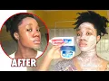 I APPLIED COLGATE TOOTHPASTE VASELINE TO MY FACE AND LOOK WHAT HAPPENED AFTER