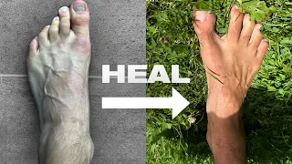 How Barefoot Training Heals the Body